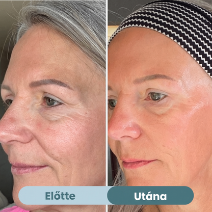 Selia Beauty - Bio-Kollagén Maszk